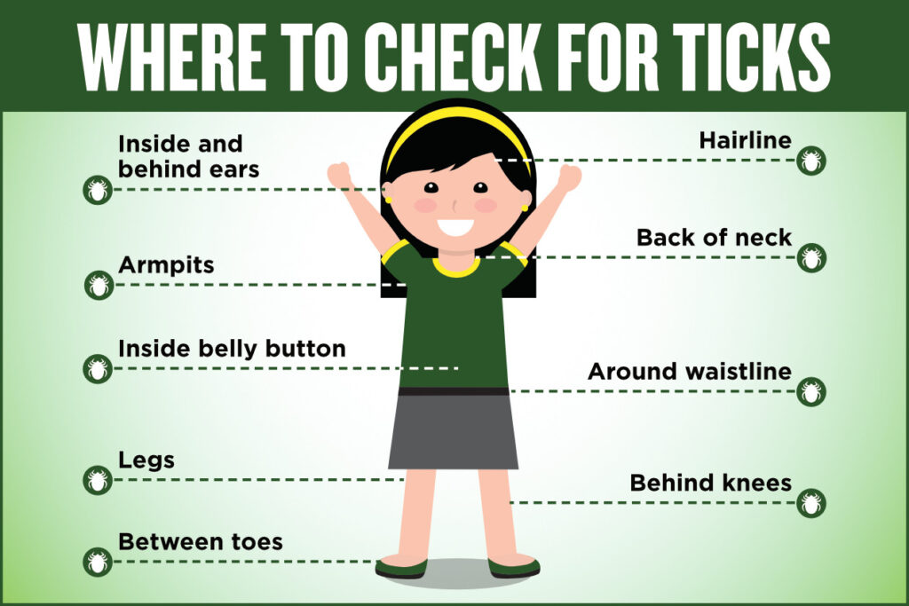 Where to Check for Ticks