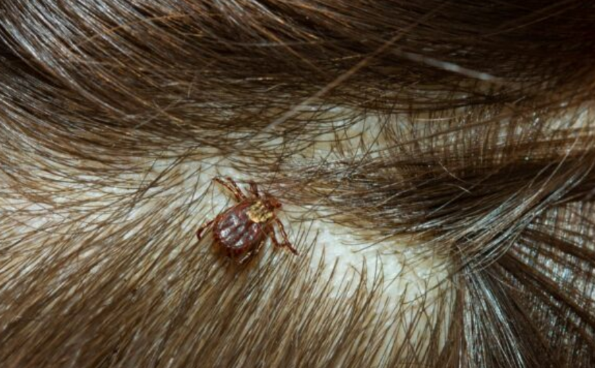 brown dog tick